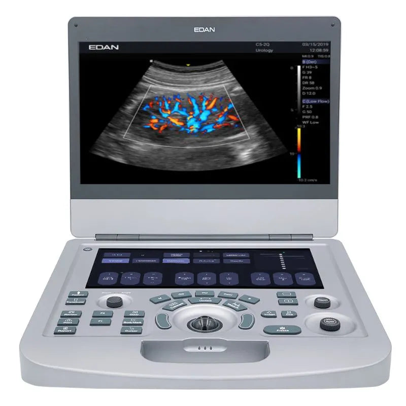 Edan Acclarix AX3 Veterinary Portable Ultrasound Machine