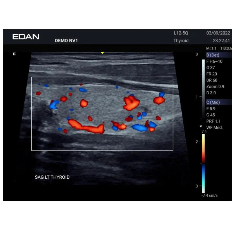 Edan Acclarix AX3 Veterinary Portable Ultrasound Machine