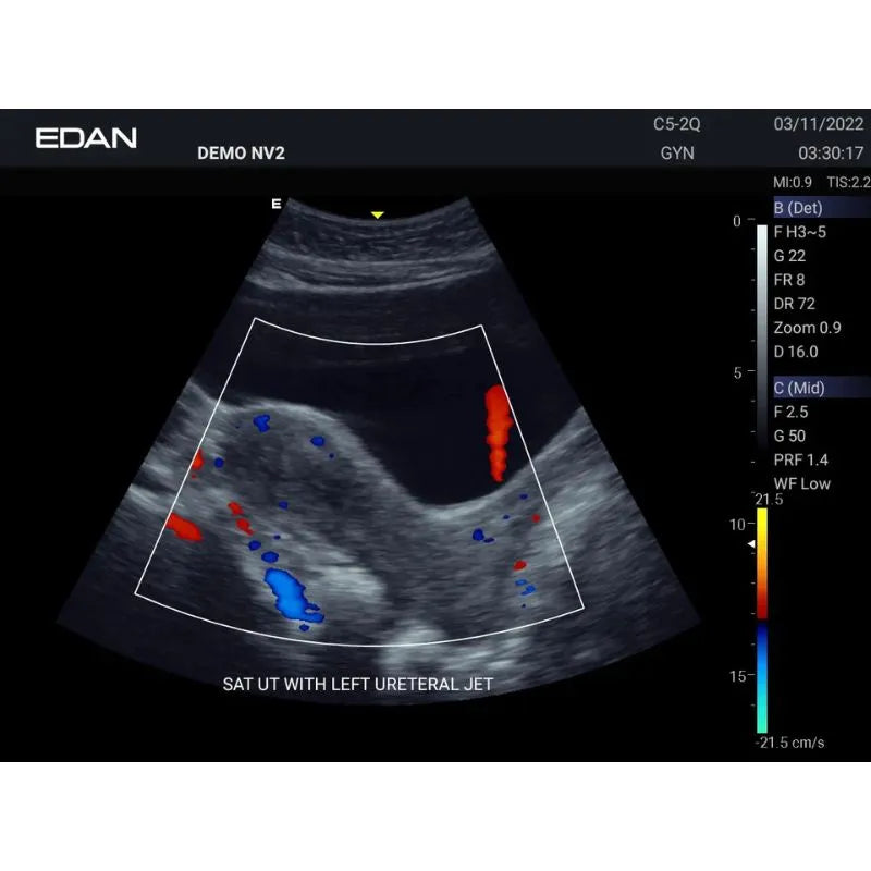 Edan Acclarix AX3 Veterinary Portable Ultrasound Machine