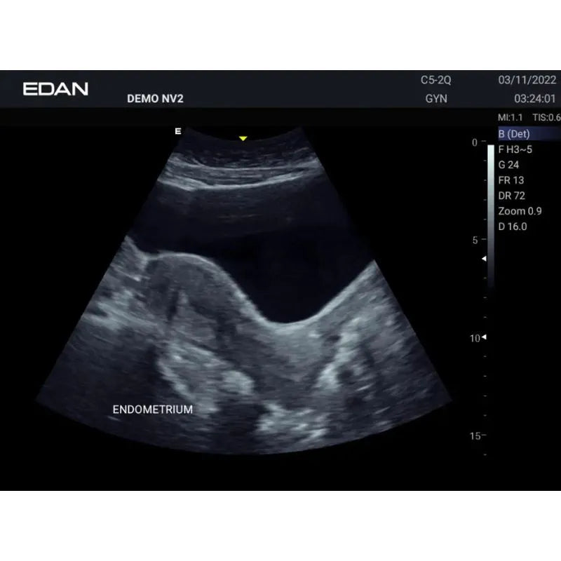 Edan Acclarix AX3 Veterinary Portable Ultrasound Machine