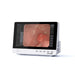 A HOS VET endoscopy monitor with a white casing and a black bezel, displaying a live internal view on its screen, set against a plain white background.