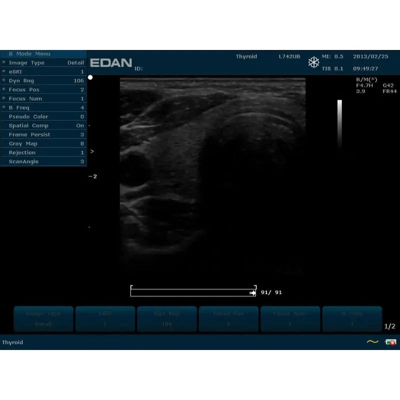 Edan Acclarix AX3 Veterinary Portable Ultrasound Machine